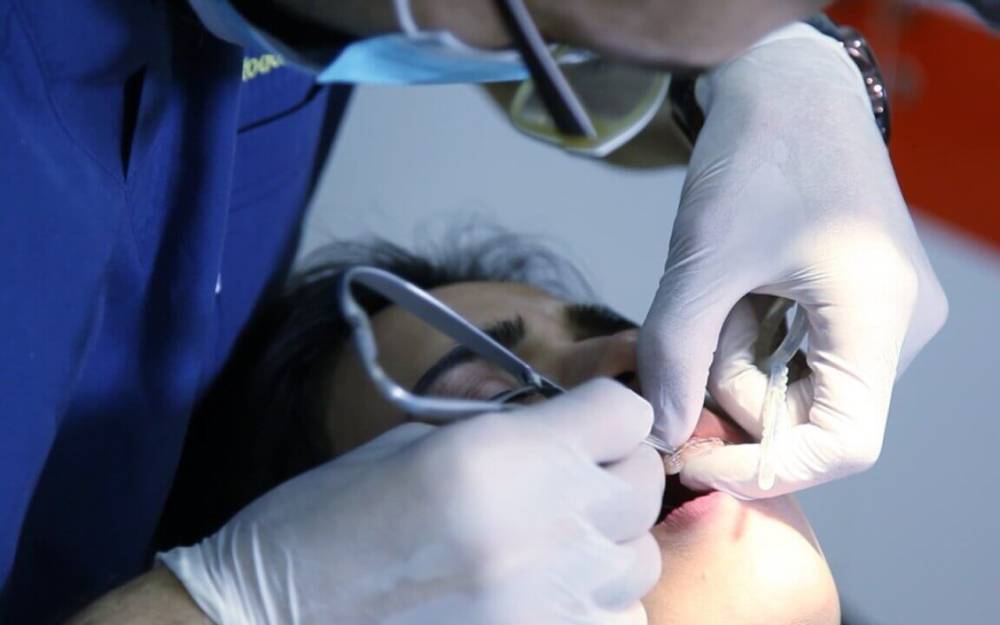 Azərbaycanda 74 stomatoloqun qanunsuz fəaliyyəti aşkarlanıb